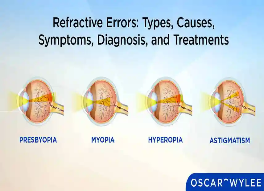 Refractive Errors: Types, Symptoms & Treatments